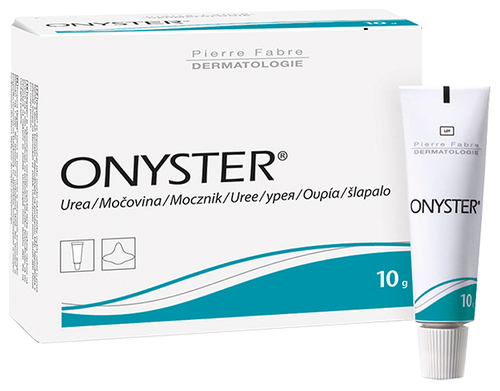 Onyster Nagelset